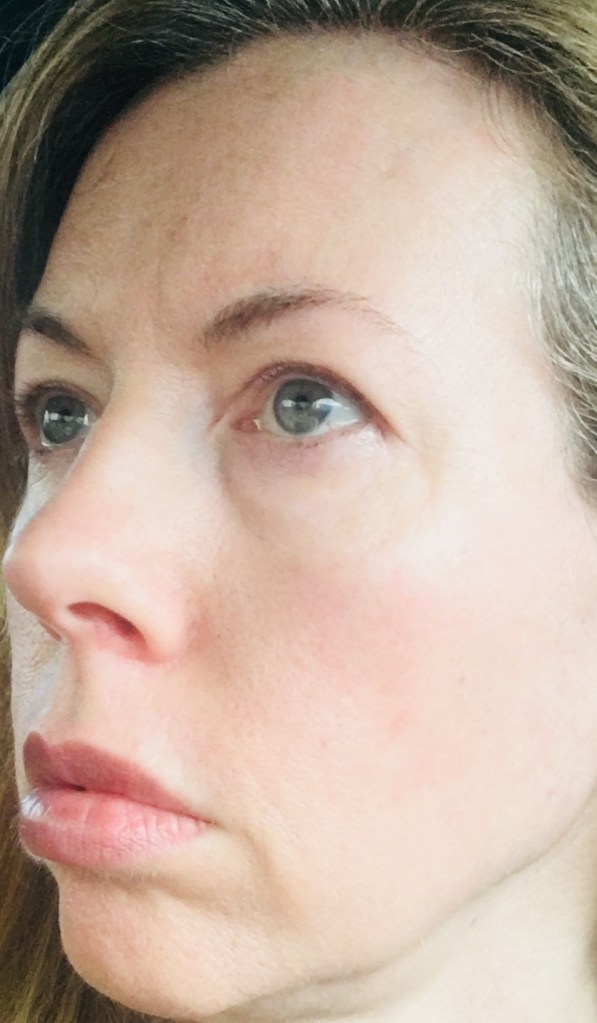 March 2020: Clear Skin, No Makeup